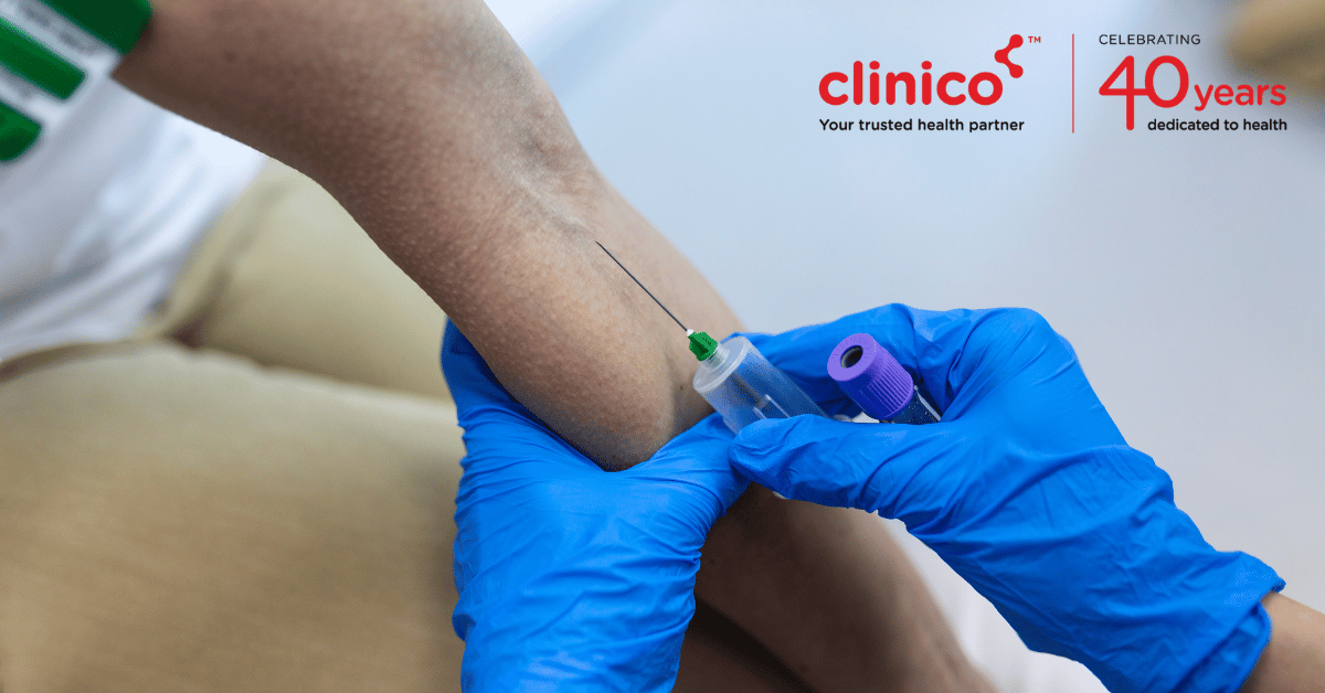 What is the importance of the Lipid Profile Test?