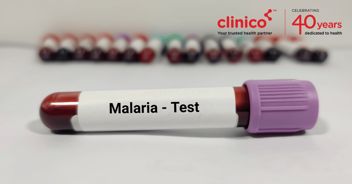 What are the diagnostic tests for Malaria?