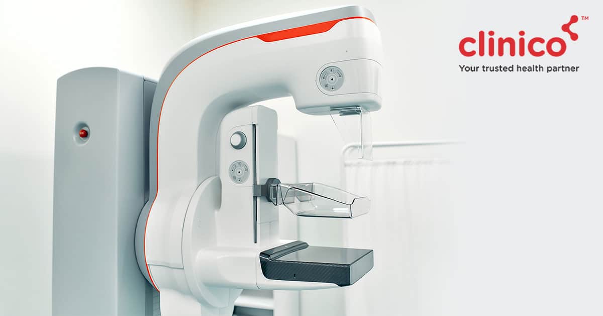 What is the importance of the Lipid Profile Test?