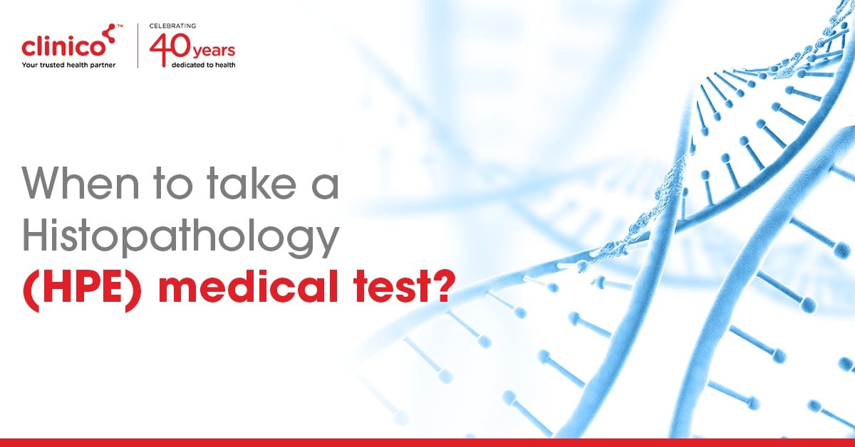 When to take a Histopathology (HPE) medical test?