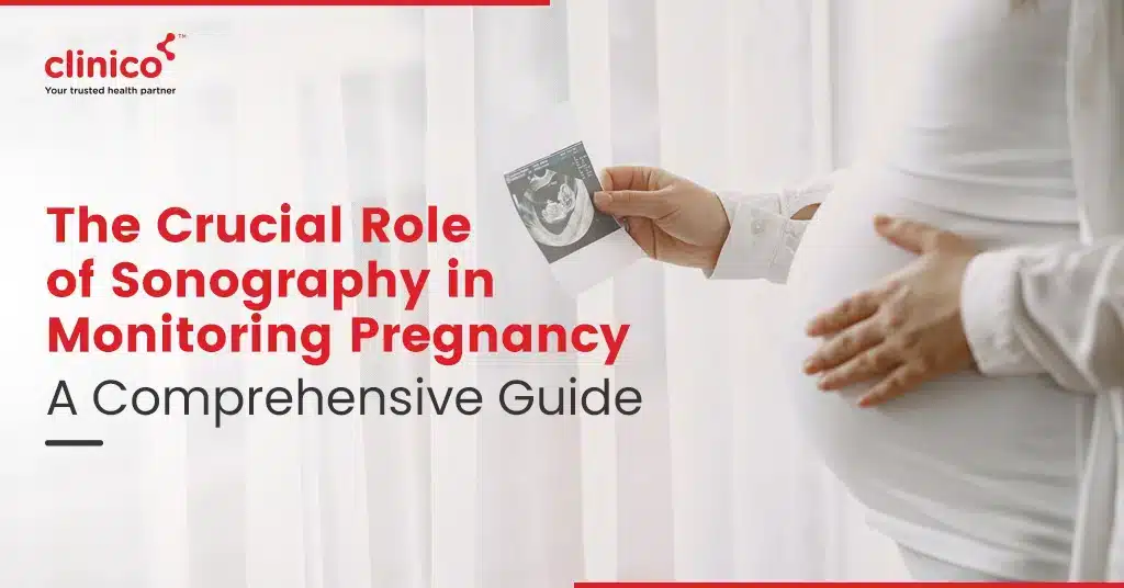 The Crucial Role Of Sonography In Monitoring Pregnancy A Comprehensive Guide