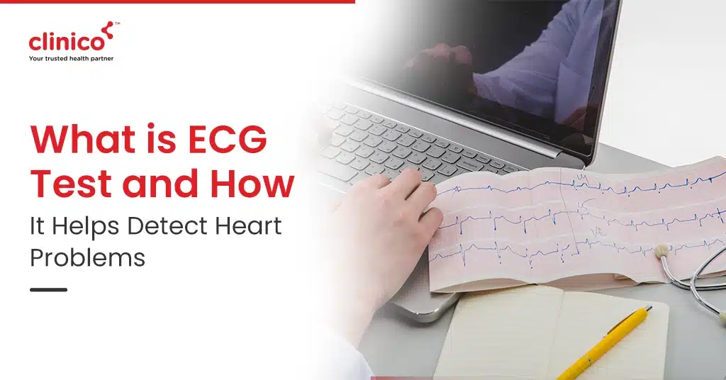 what is ecg test