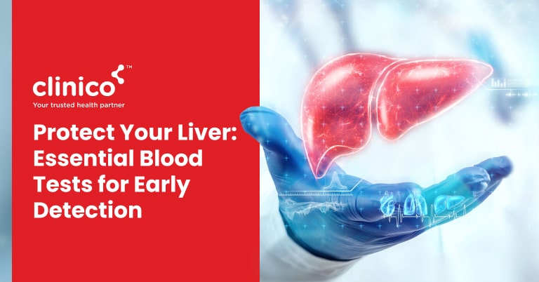 Protect Your Liver: Essential Blood Tests for Early Detection