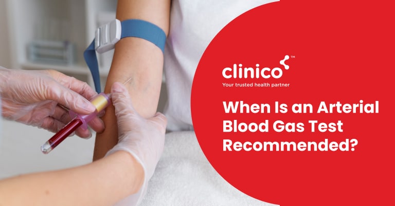 When Is an Arterial Blood Gas Test Recommended?